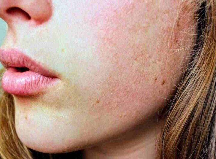 Non sottovalutare i puntini bianchi sulle labbra, tutti i dettagli